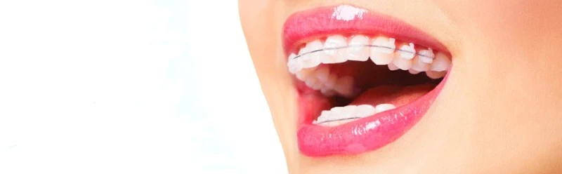 Clínica Dental Adelaida Parra - Dentista Torrelodones