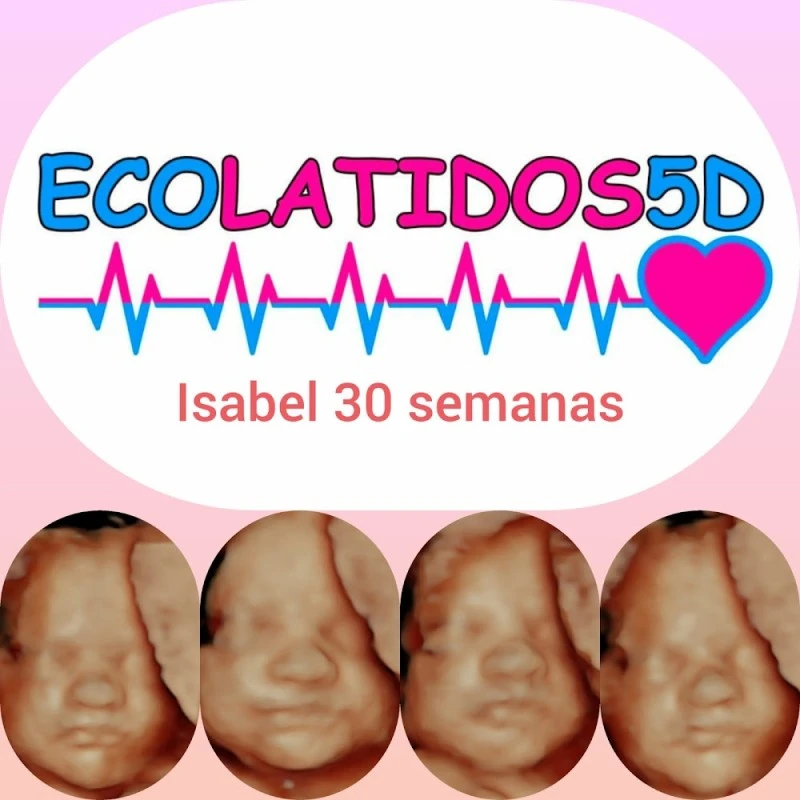 Ecolatidos 5D - Especialistas en Ecografia 5D y 4D
