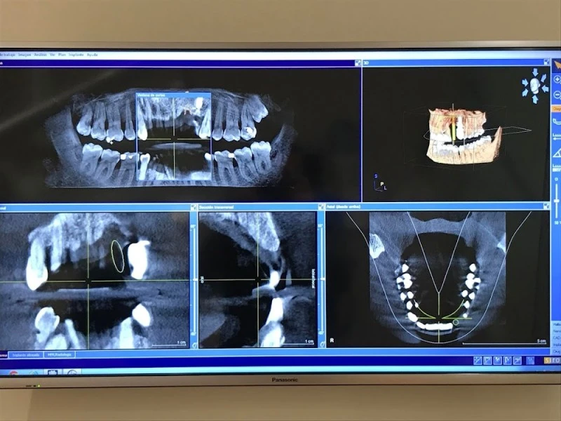 EspaiDental - Aleixandre Sanchis. Clínica Dental Picanya