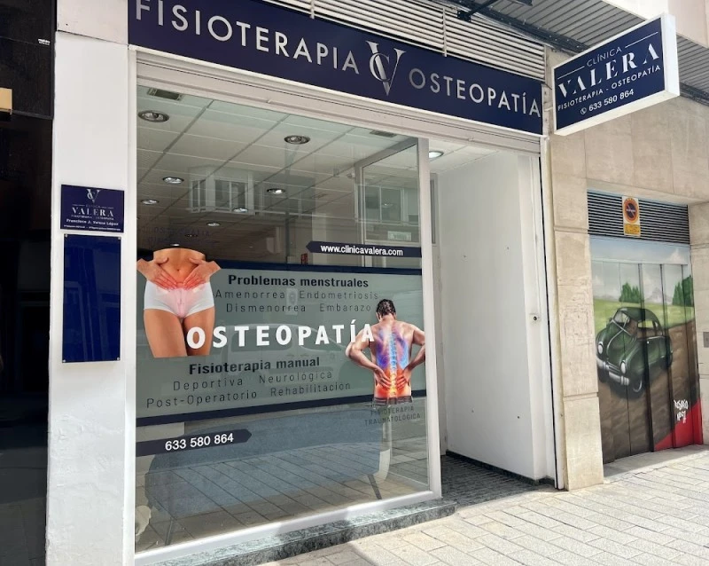 Fisioterapia Valera Albacete - A domicilio