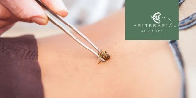 Apiterapia Alicante