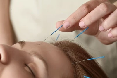 AURORA SALUD-Clinica de acupuntura y terapias orientales