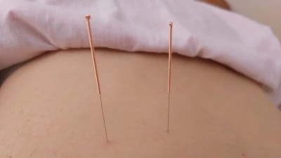 Ballesteros Acupuntura