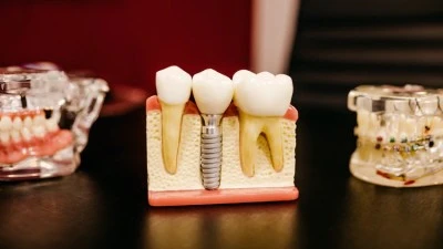 Álvarez clínica dental