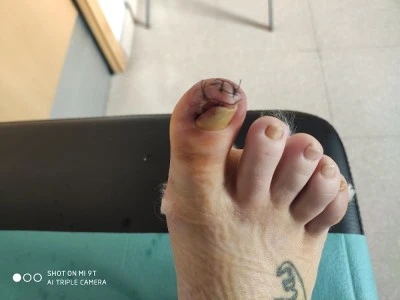 Clínica del pie podomagina Asier Galiano Bolea