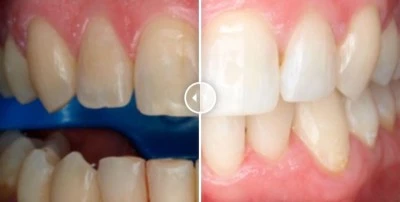 Clinica Dental Chafarinas