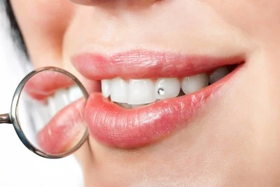 Clinica Dental Dr. Rene Rojas Serrano
