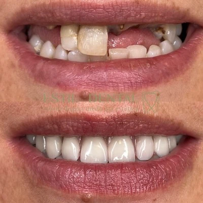 Clínica Dental Estil Dental Mollerussa