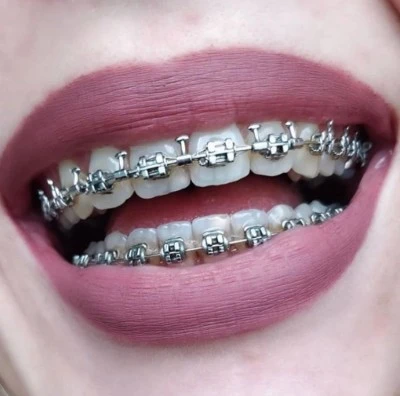 Clínica Dental Gloria Villena