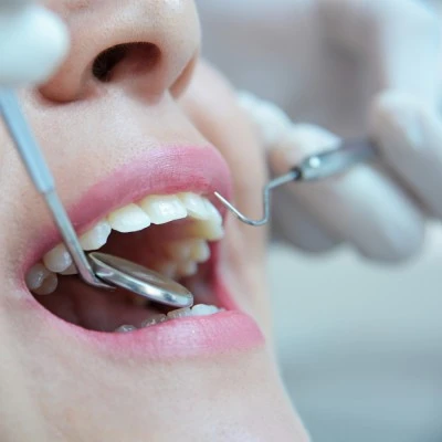 CLINICA DENTAL ILLESTAS - ORTODONCIA - IMPLANTES - AMERICA