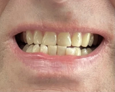 Clínica Dental Implantdent Palafrugell