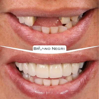 Clínica Dental Integral Dr. Bruno Negri