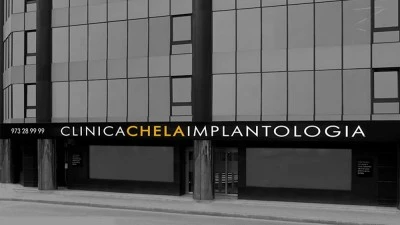 Clinica Dental Lleida Clinica Chela Implantologia