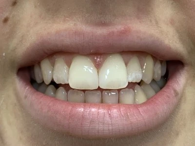 Clínica Dental Torres