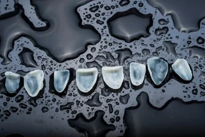 Clínica Odontología Avanzada CARBONERAS