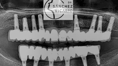 DR. SÁNCHEZ VICARIO