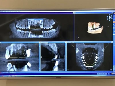 EspaiDental - Aleixandre Sanchis. Clínica Dental Picanya