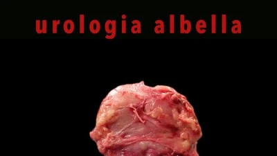 Urología Albella
