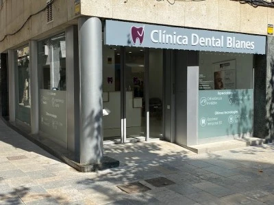 Vila Dental - Clínica Dental Blanes
