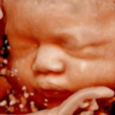 VisionBaby, Ecografía 4D/5D